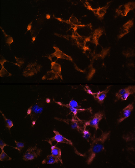 AMPH Antibody