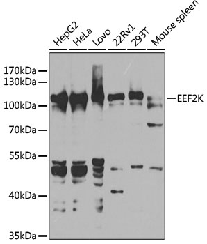 EEF2K Antibody