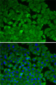 EEF2K Antibody