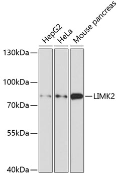 LIMK2 Antibody