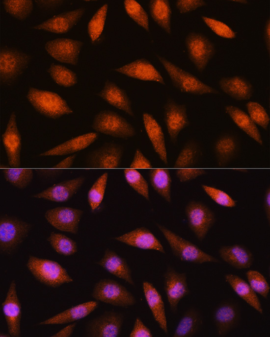 LIMK2 Antibody