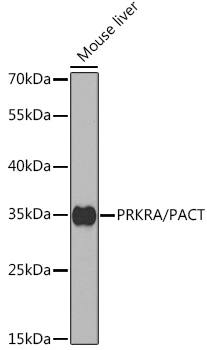 PRKRA Antibody