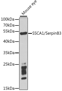 SERPINB3 Antibody