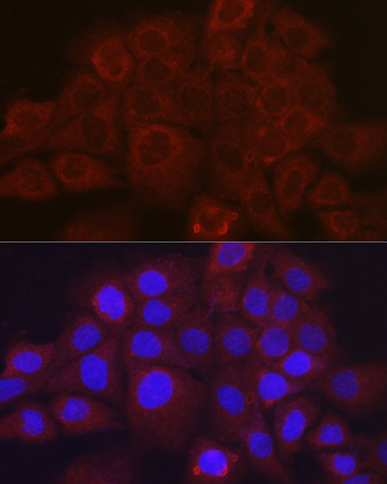 SERPINB3 Antibody