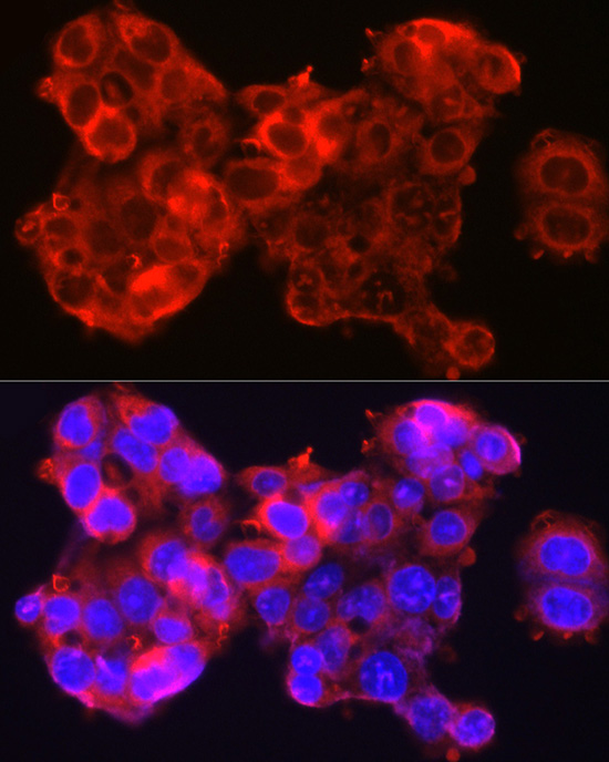 SERPINB3 Antibody