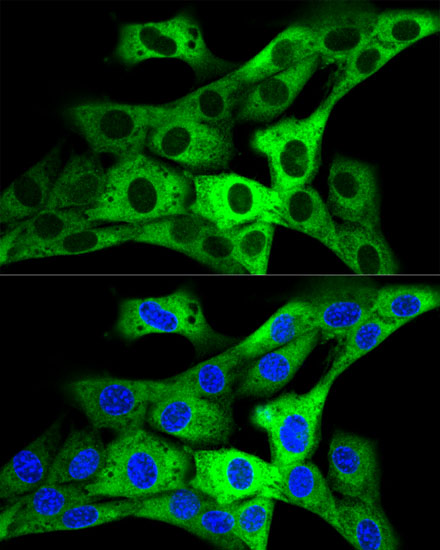 GARS Antibody