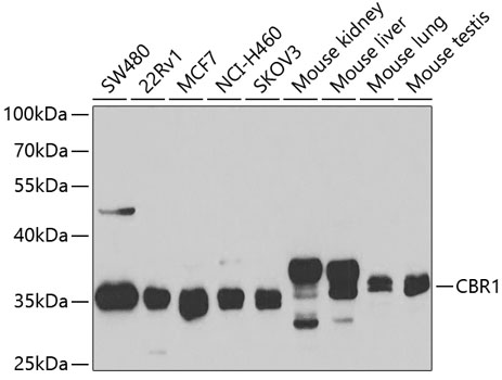 CBR1 Antibody