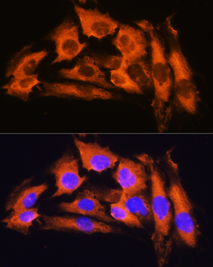 APRT Antibody