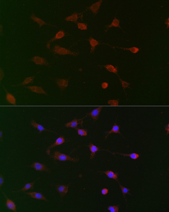 CDC34 Antibody