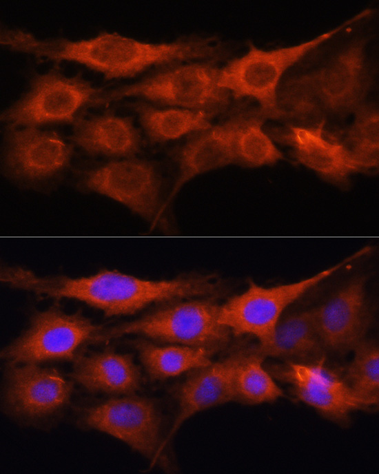 GALNS Antibody