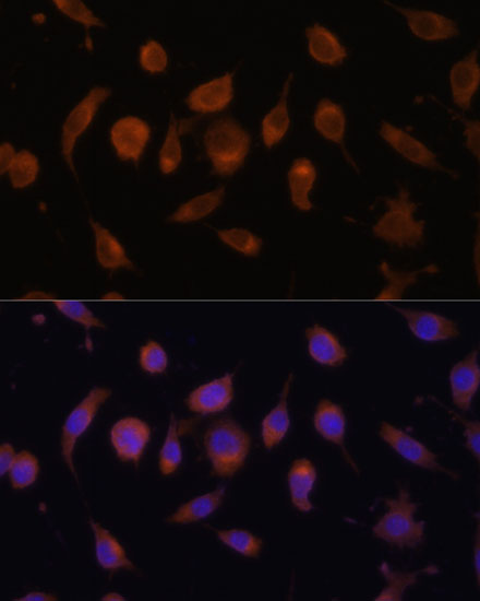 HIF1AN Antibody