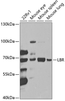 LBR Antibody