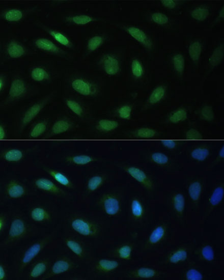 LBR Antibody