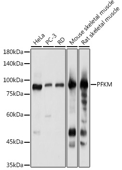 PFKM Antibody