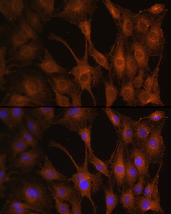 PFKM Antibody