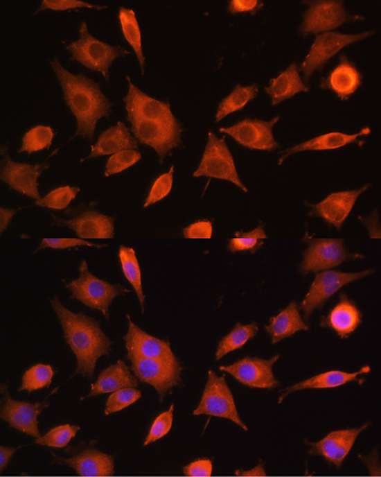 PFKM Antibody