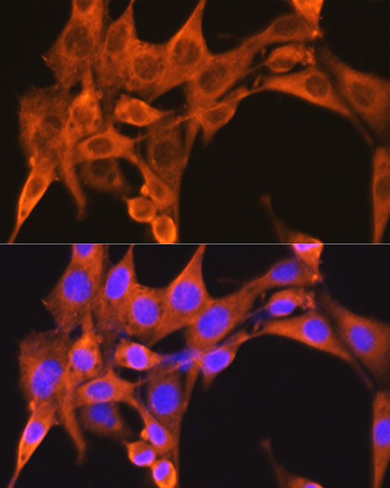 PFKM Antibody