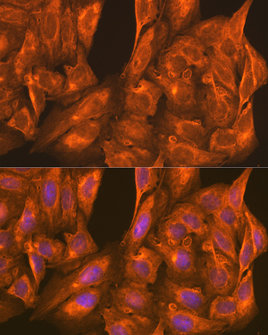 PFKM Antibody