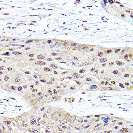 PSMB2 Antibody