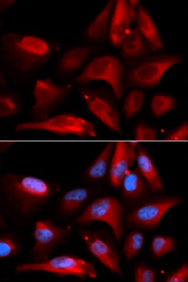 S100A11 Antibody