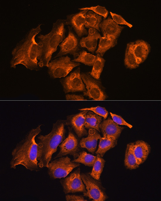 TXNRD2 Antibody