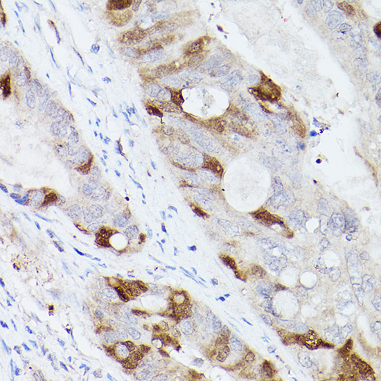 UBE2C Antibody