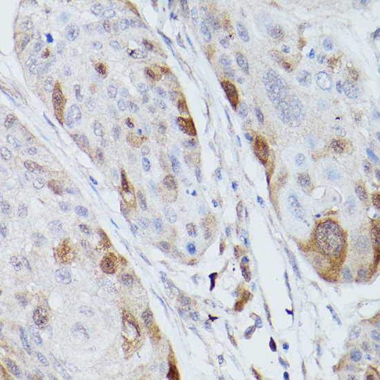 UBE2C Antibody