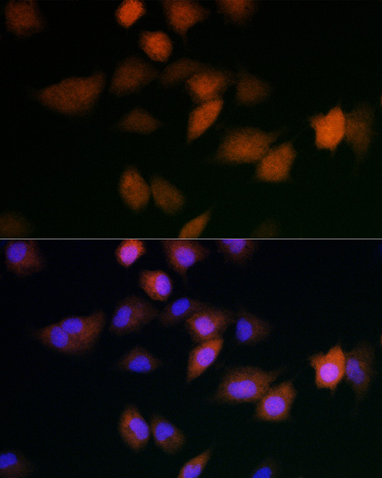 UBE2C Antibody