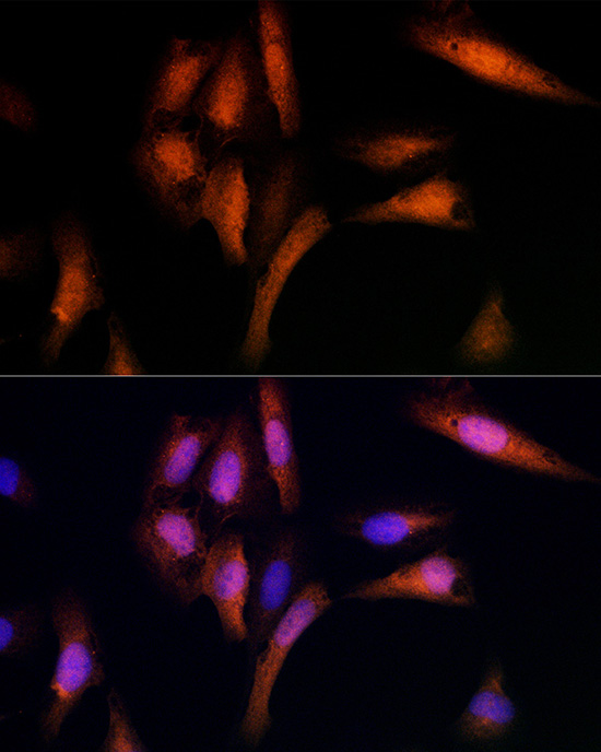 UBE2C Antibody