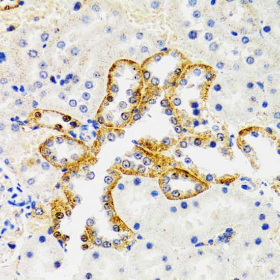 SH2B1 Antibody