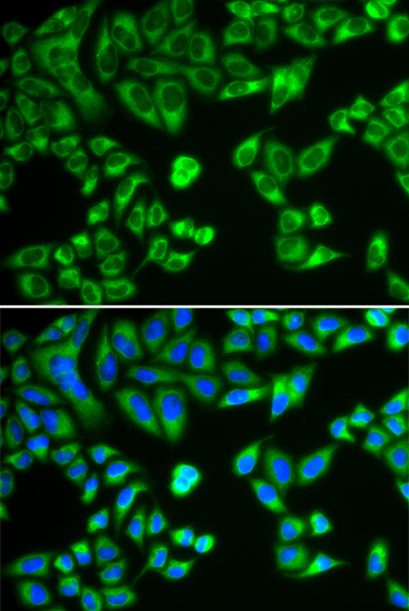 SH2B1 Antibody