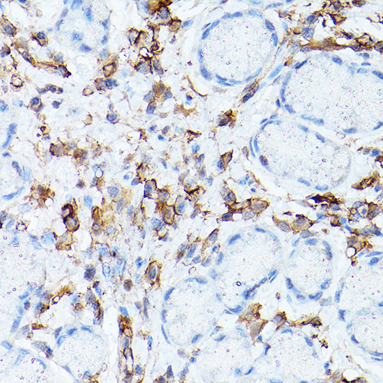 ICAM1 Antibody