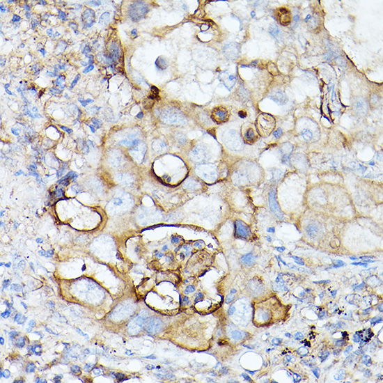 ICAM1 Antibody