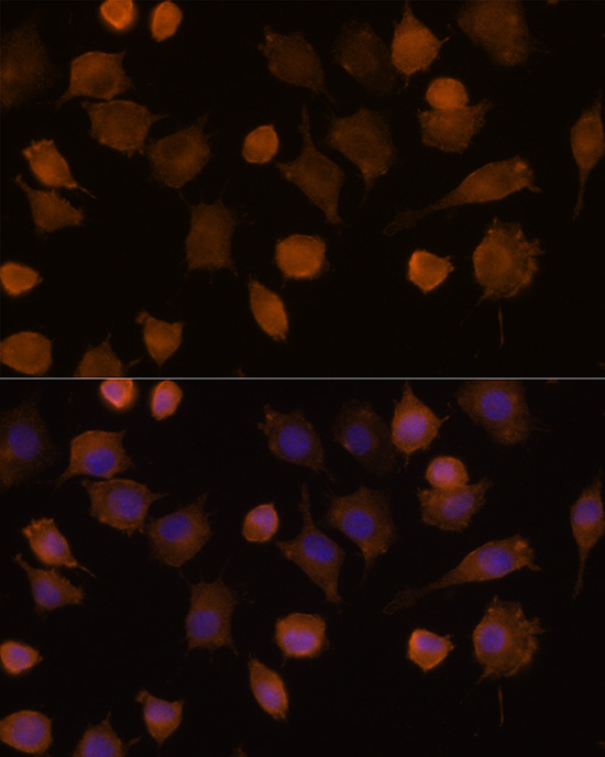 ICAM1 Antibody