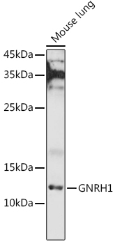 GNRH1 Antibody