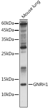 GNRH1 Antibody