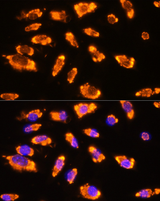 GNRH1 Antibody