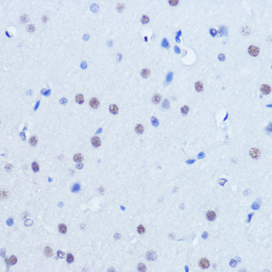 PIAS2 Antibody