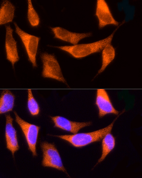 ROCK2 Antibody