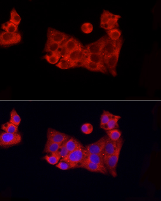 ROCK2 Antibody