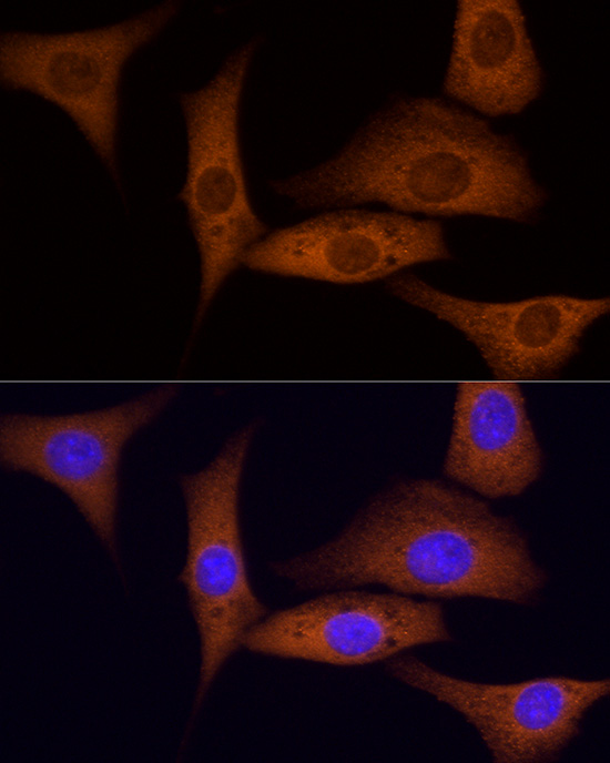 ROCK2 Antibody