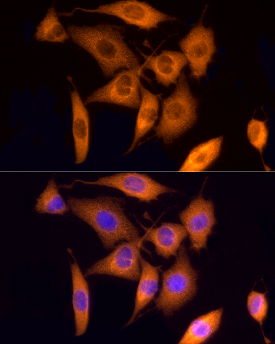 ROCK2 Antibody