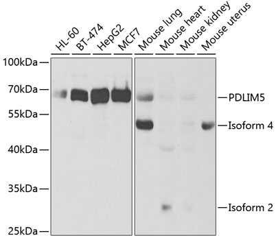 PDLIM5 Antibody