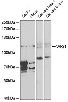 WFS1 antibody