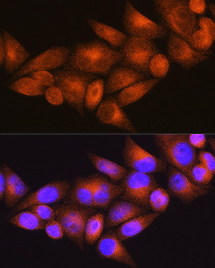 WFS1 antibody