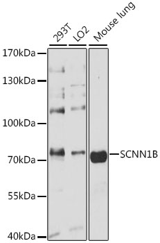 SCNN1B antibody