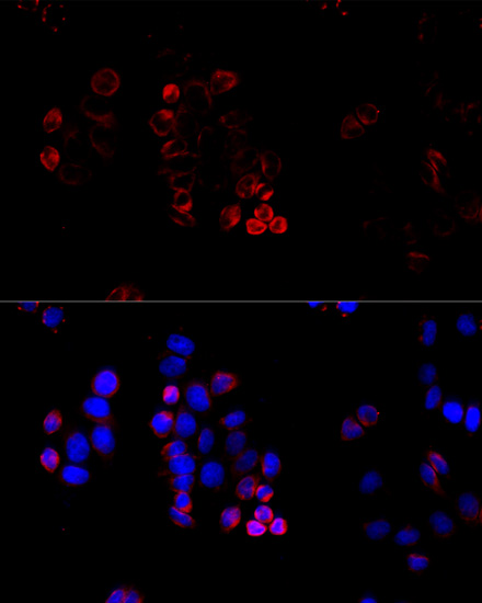 ABCG8 antibody