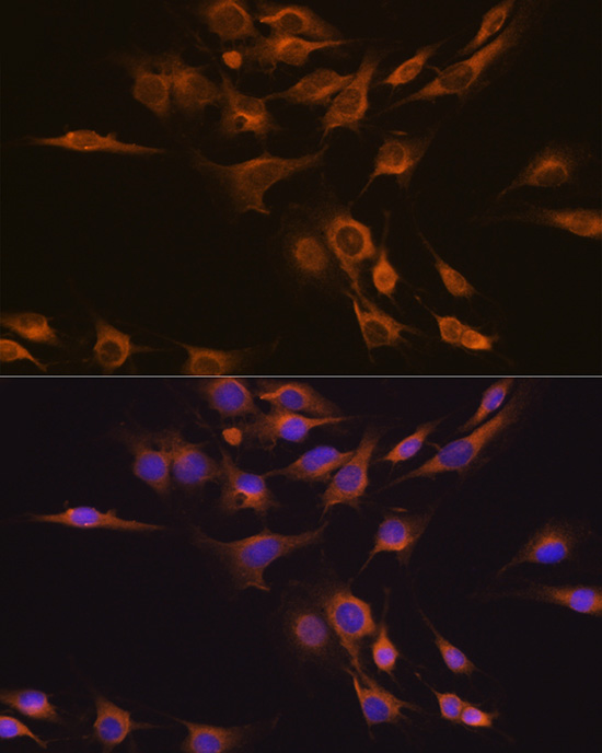 CNTF antibody