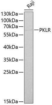 PKLR antibody