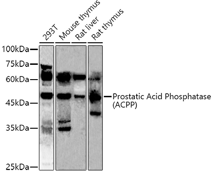 ACPP antibody